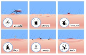 Picaduras De Insectos. Sabes Identificarlas. – Levante Desinfeccion